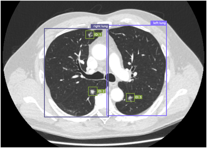 FIGURE 3