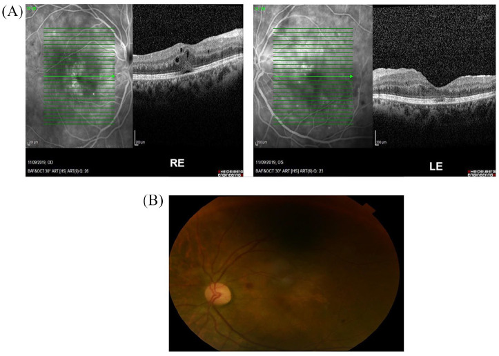 Figure 3.