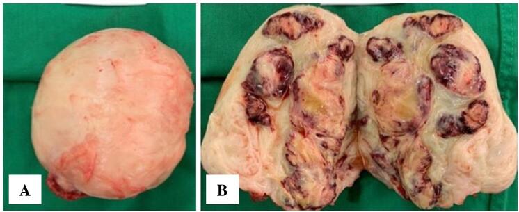 Fig. 2