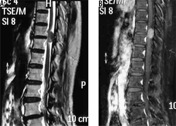 Figure 21