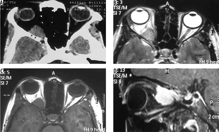 Figure 19