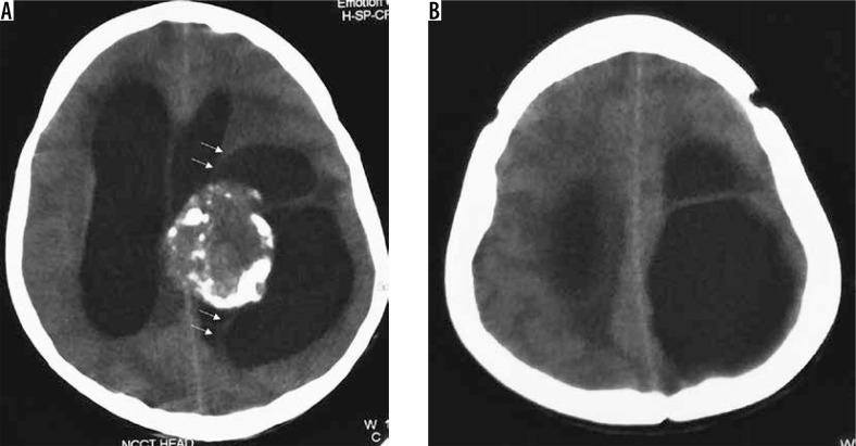 Figure 26