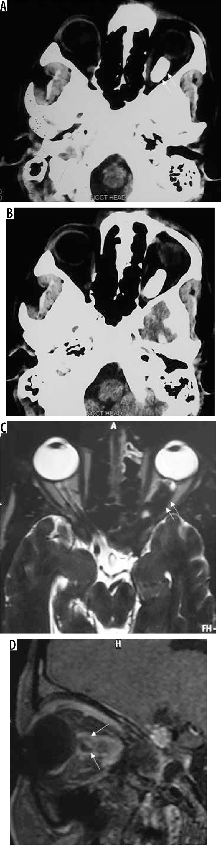 Figure 18