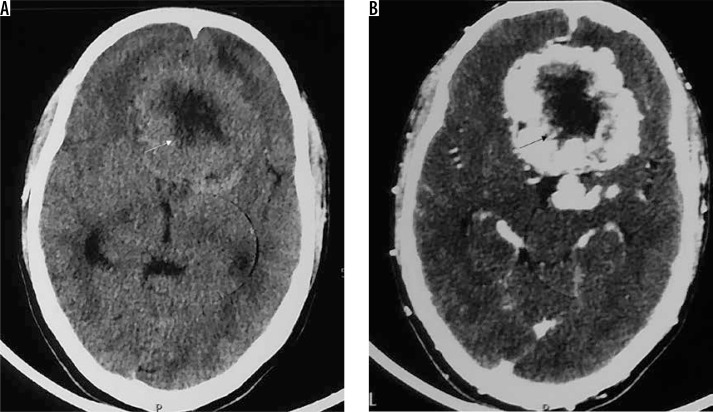 Figure 23