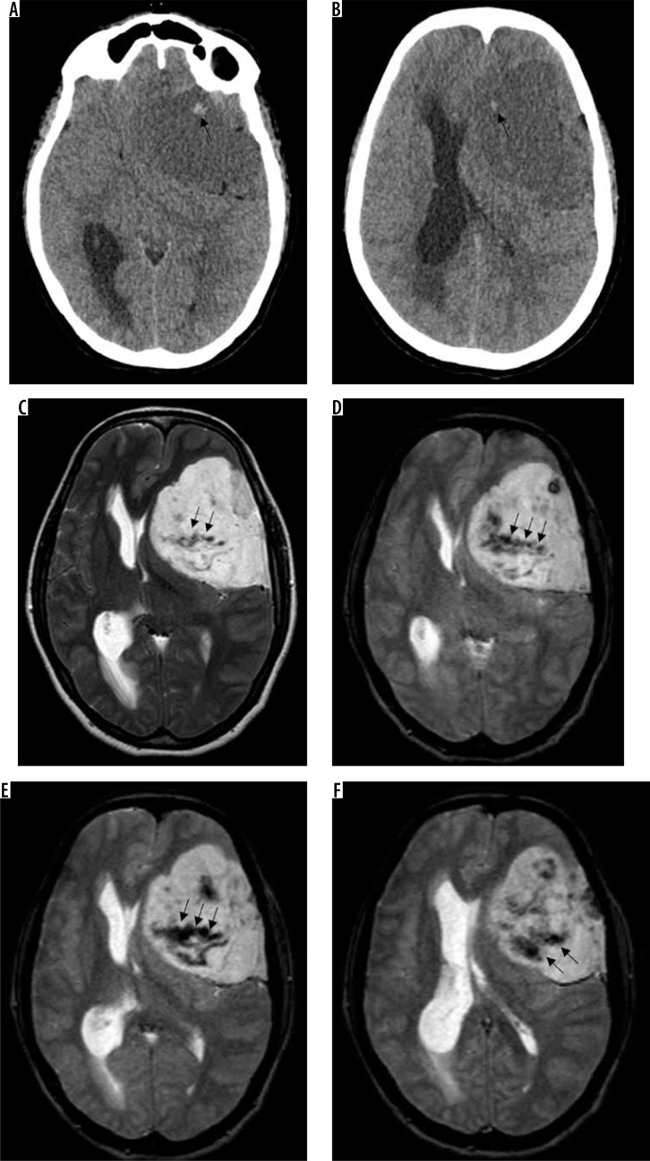 Figure 22