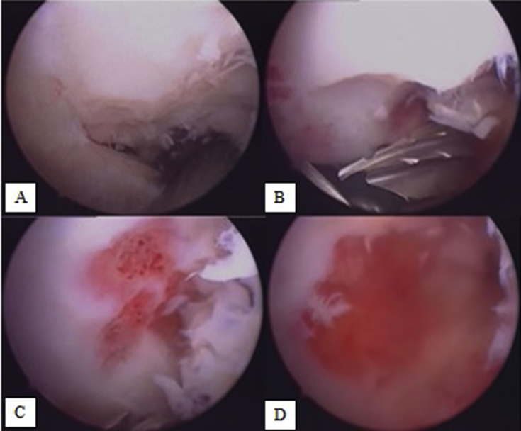 Fig. 3