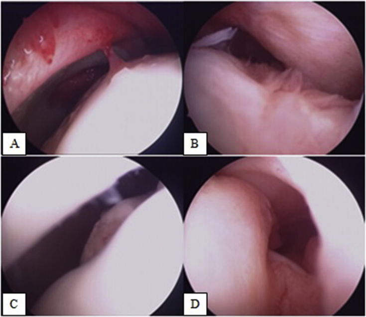 Fig. 1