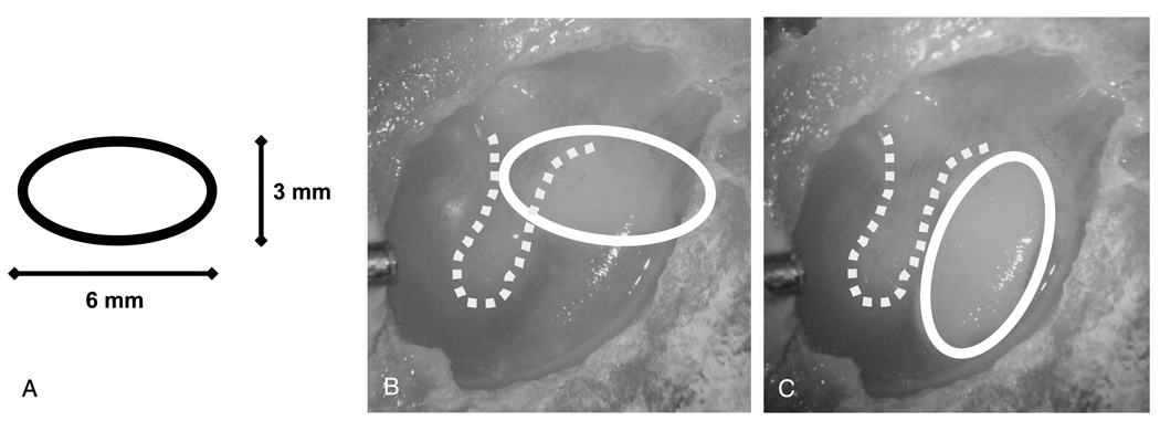 FIG. 1