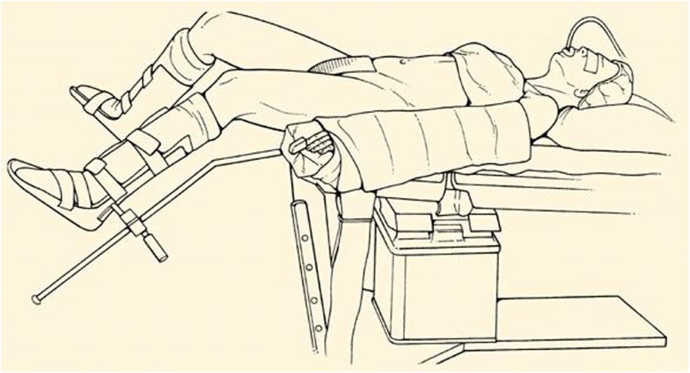 Fig. 2