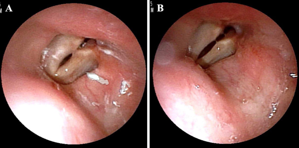 FIG. 3.