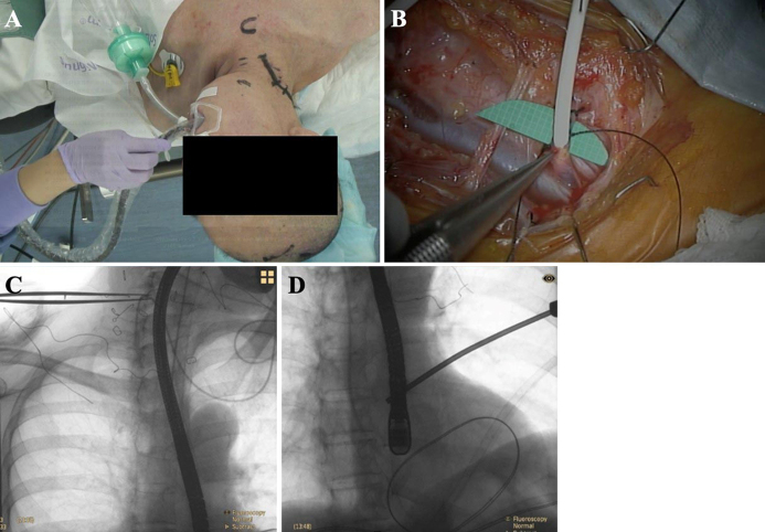 FIG. 2.