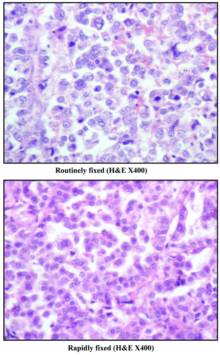 [Table/Fig-5B]: