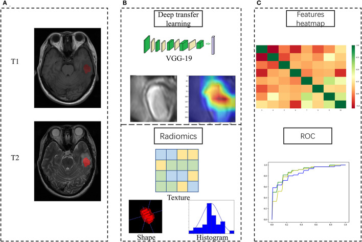 Differentiation of Brain Abscess From Cystic Glioma Using Conventional ...