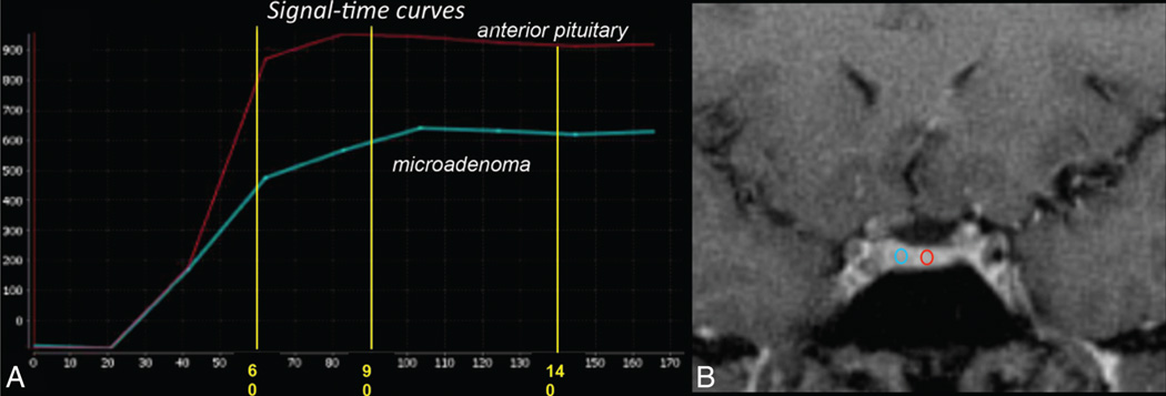 FIG 3