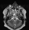 Fig. 1