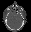 Fig. 2