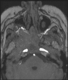 Fig. 3