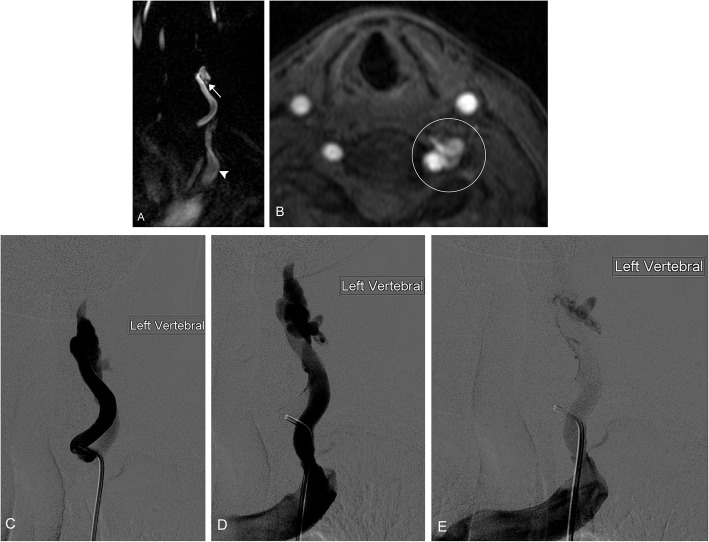 Fig. 12