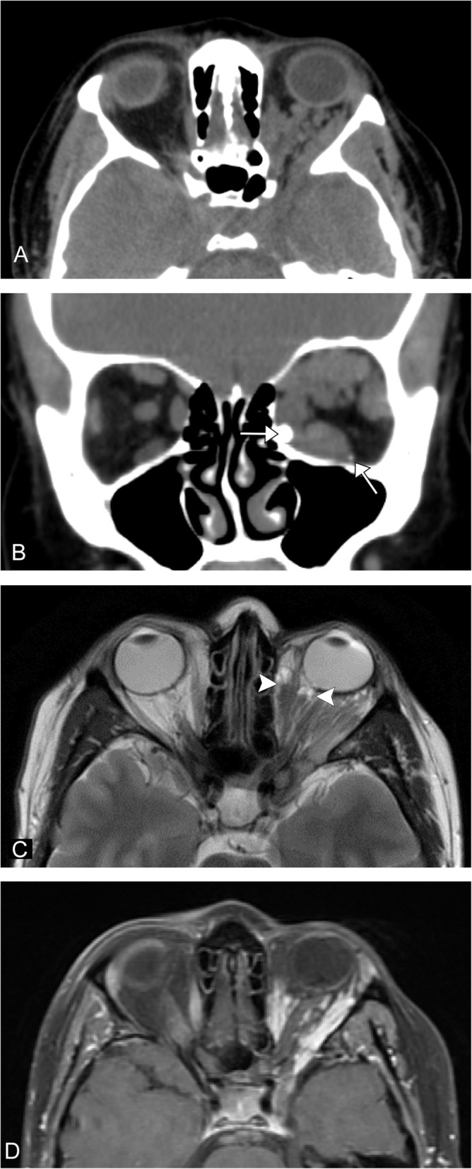 Fig. 13
