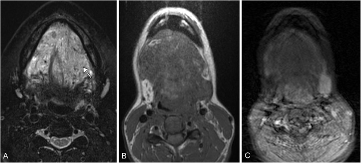 Fig. 10