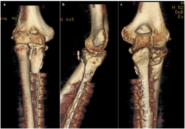 Figure 4