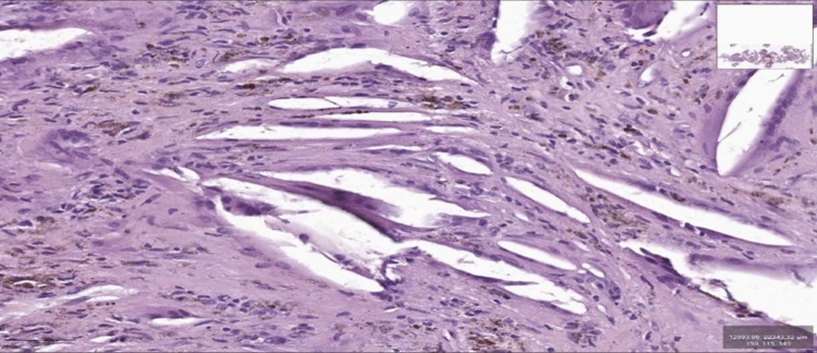 Fig. 3