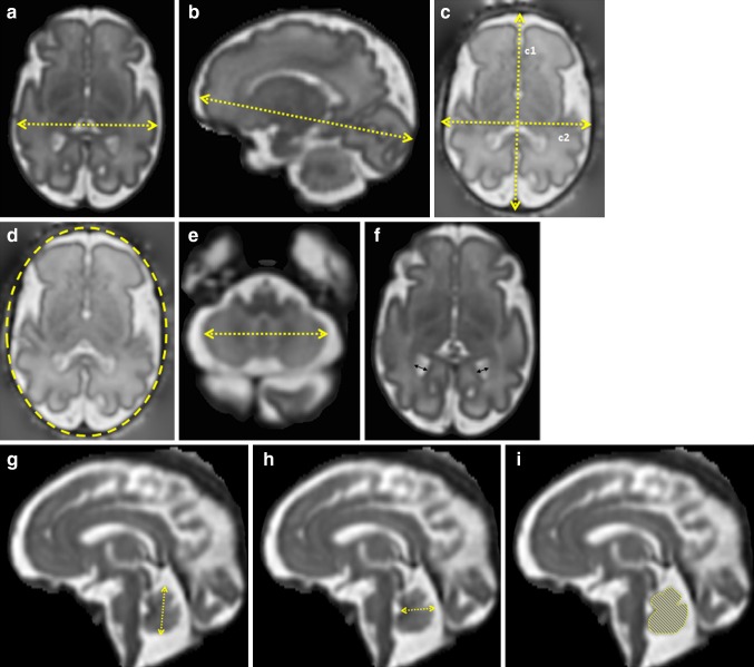 Fig. 3