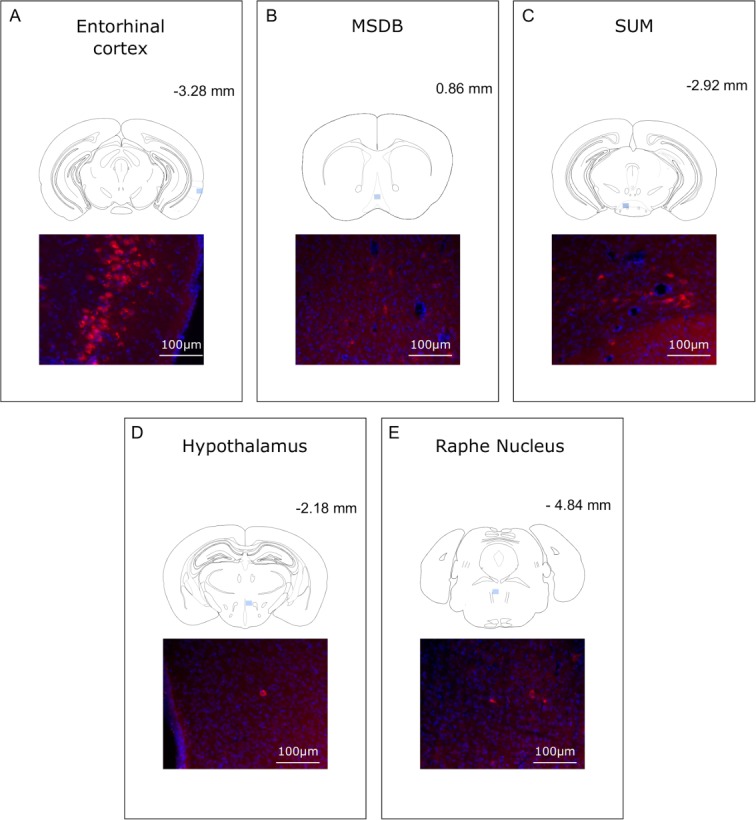 Figure 1—figure supplement 3.