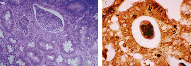 Figure 14.3