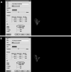Figure 5. (A) Pretreatment volume measurement. (B) Posttreatment values.