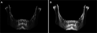 Figure 2. (A) Pretreatment. (B) Posttreatment images.