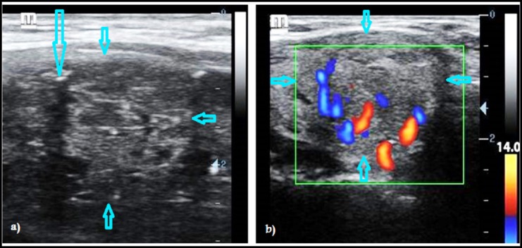 Fig.2