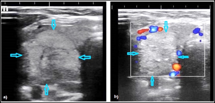 Fig.1