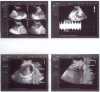 Fig. 2: