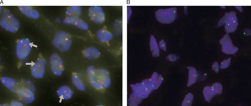 FIGURE 3