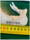 Figure 26