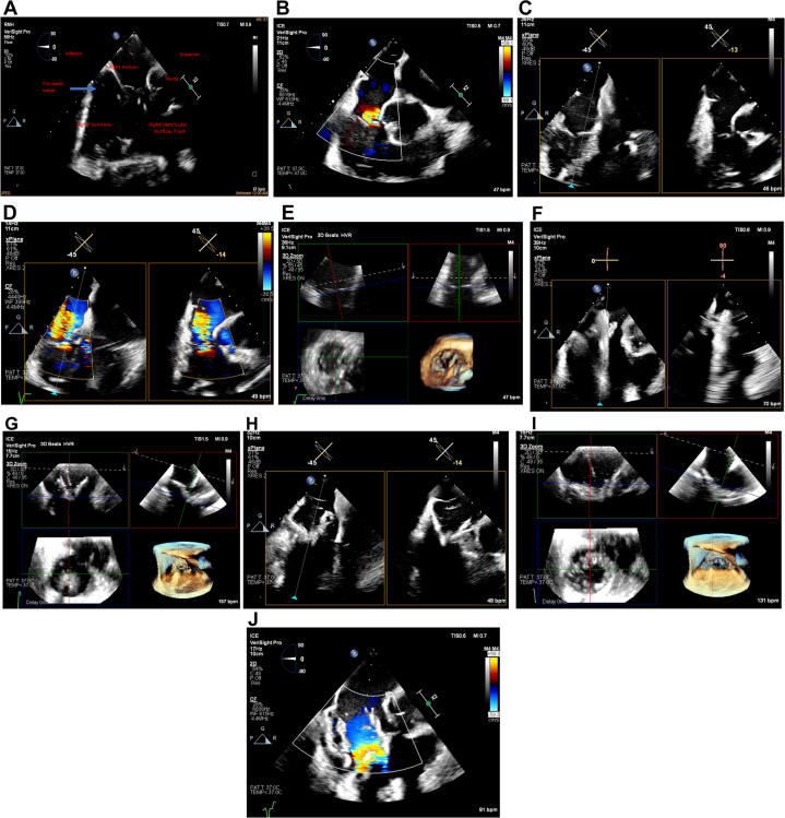 Figure 1