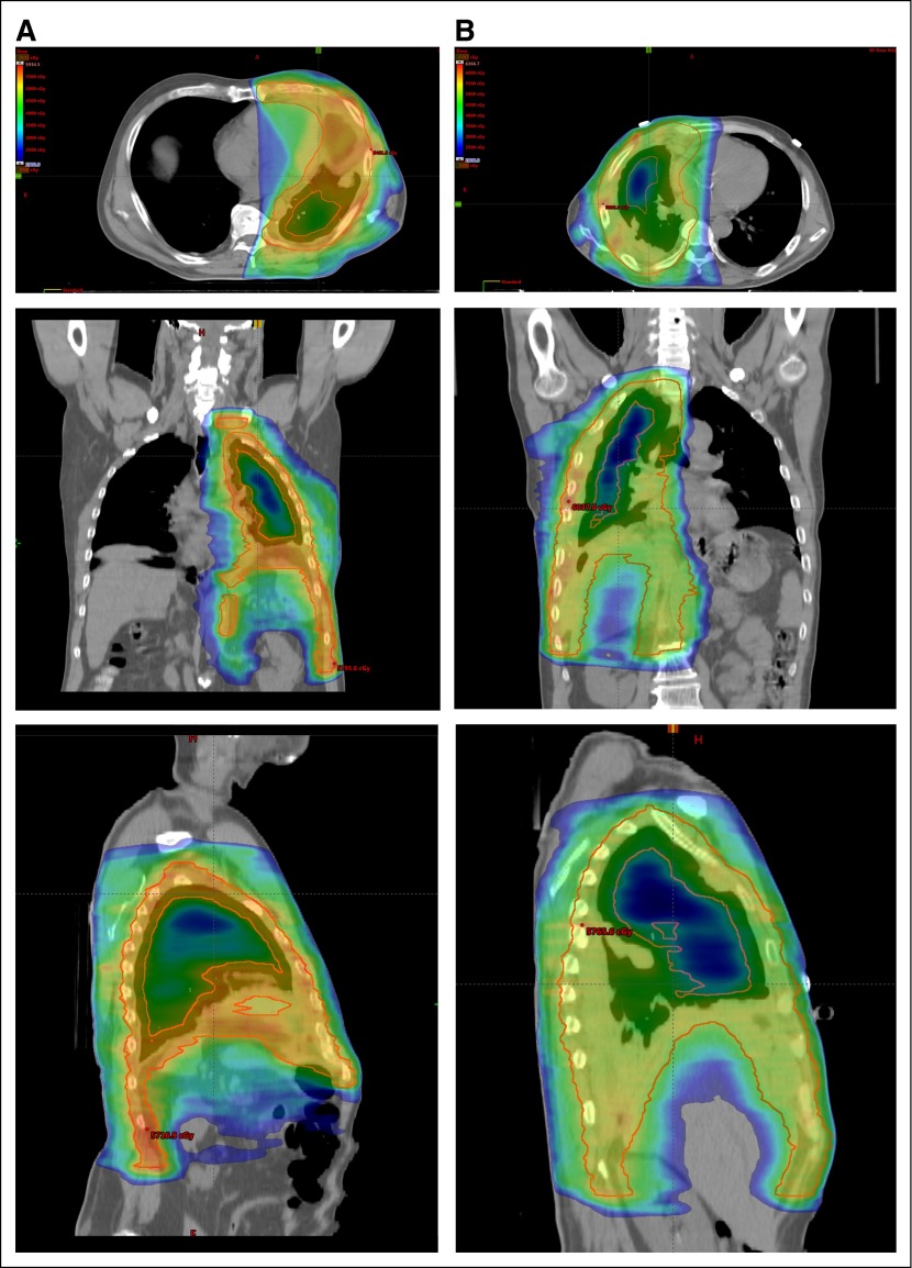 Fig 2.
