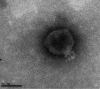 FIG 1