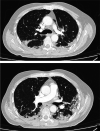Fig 2.