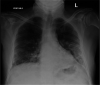 Fig 1.