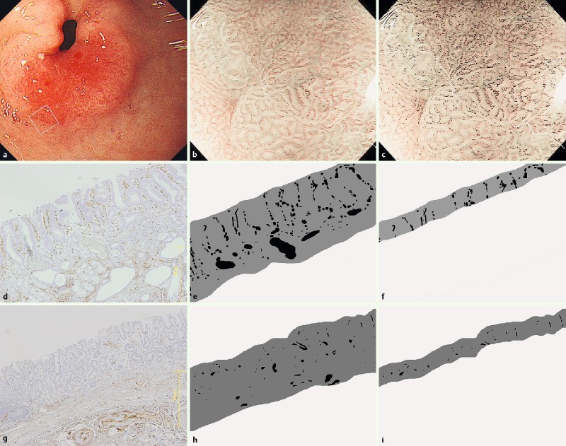 Fig. 1 a