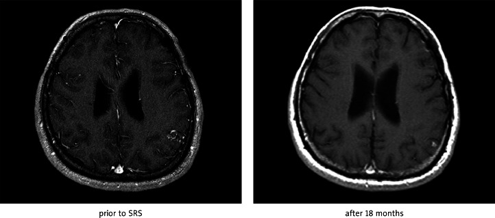 Fig. 1B