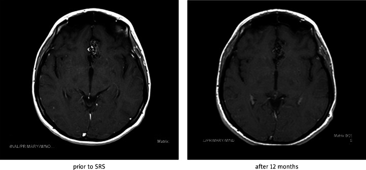 Fig. 1A