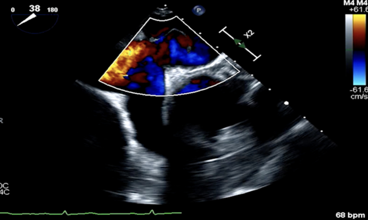 Figure 4