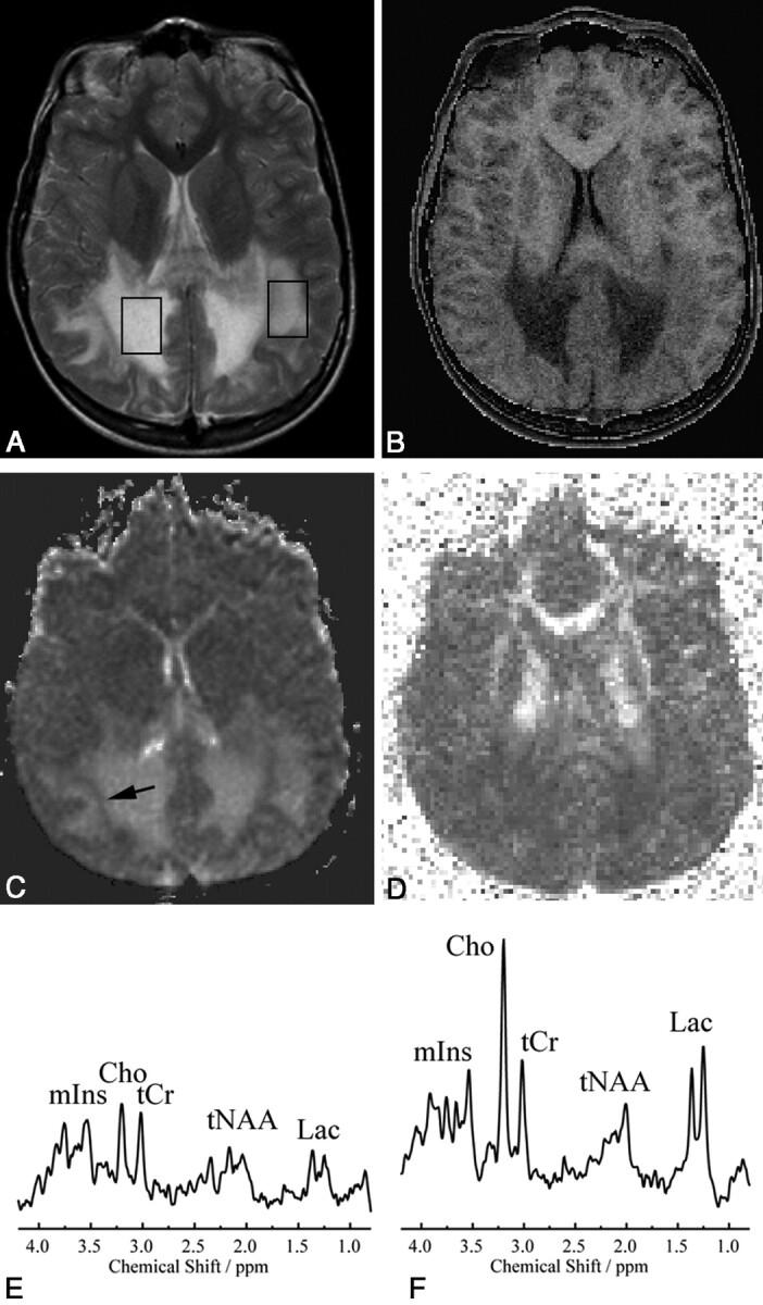 Fig 1.