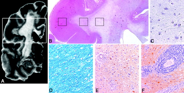 Fig 3.