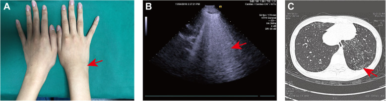 Fig. 2