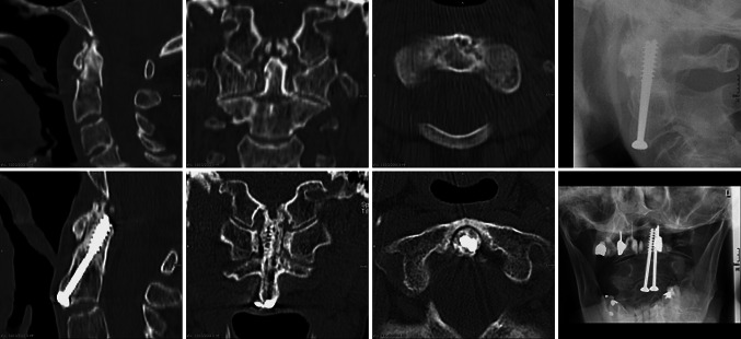 Fig. 2