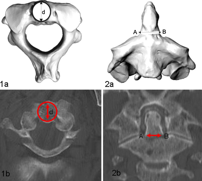 Fig. 1